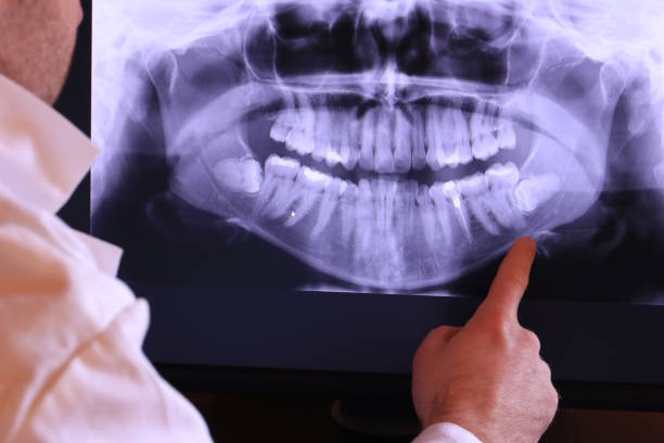 Best Chipped Tooth Repair Near Me  in Merritt Park, NY
